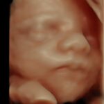hdlive fetal face