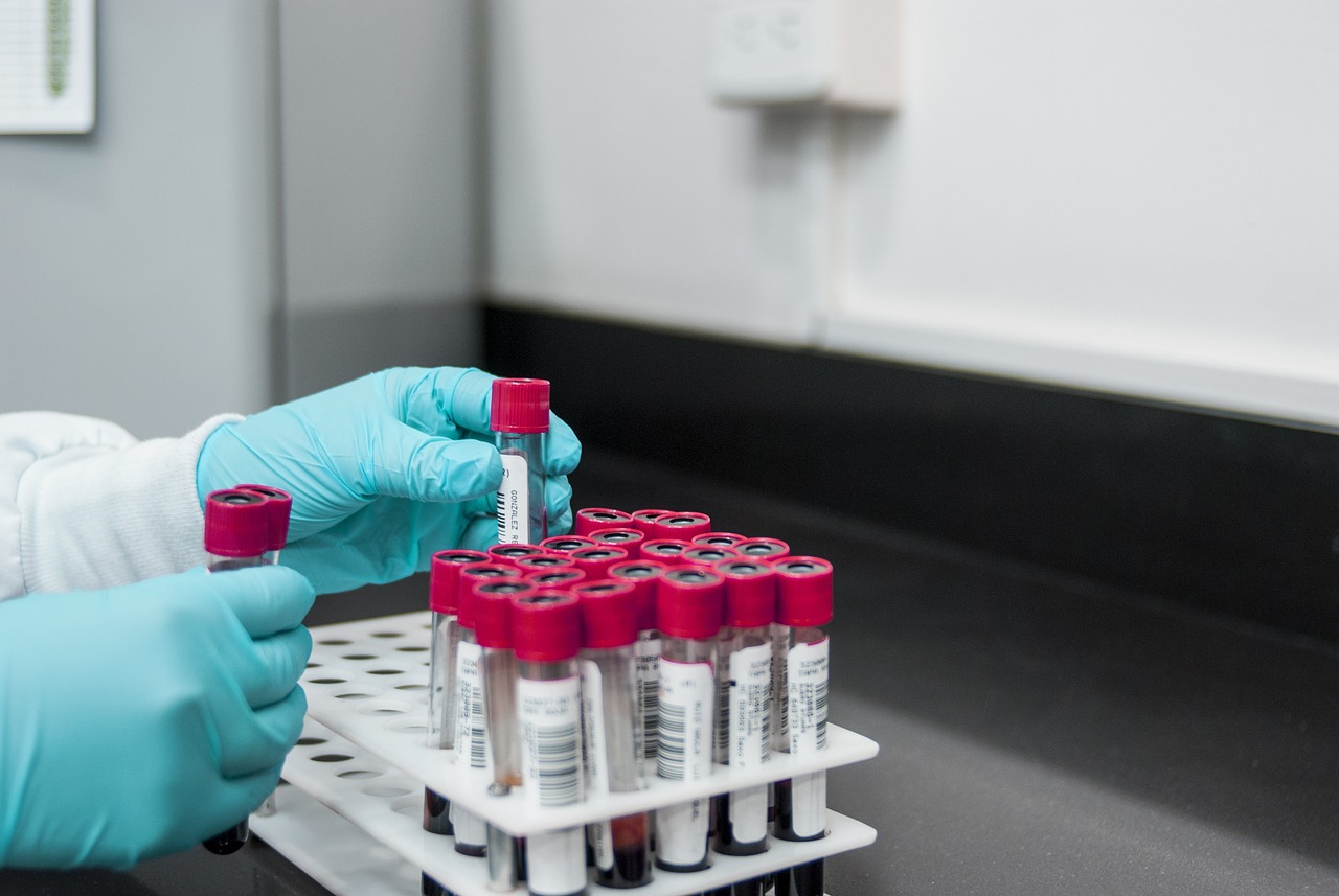 La guida semplice per capire le tue analisi del sangue