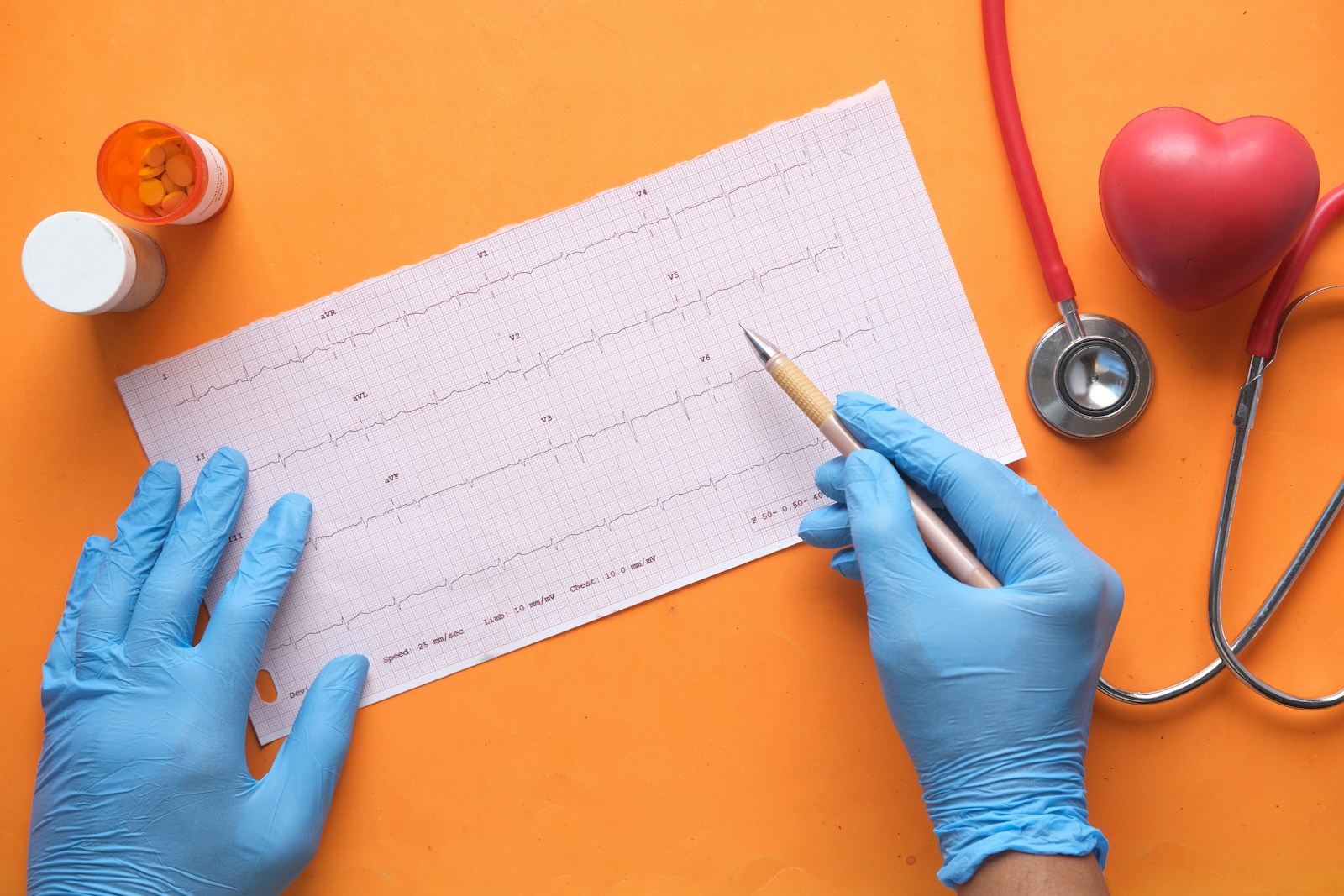 Elettrocardiogramma: guida pratica per capire il tuo cuore in pochi minuti